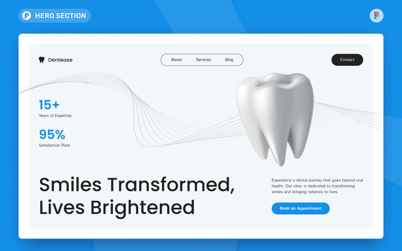 Dentease -牙科诊所英雄部分的Figma模型