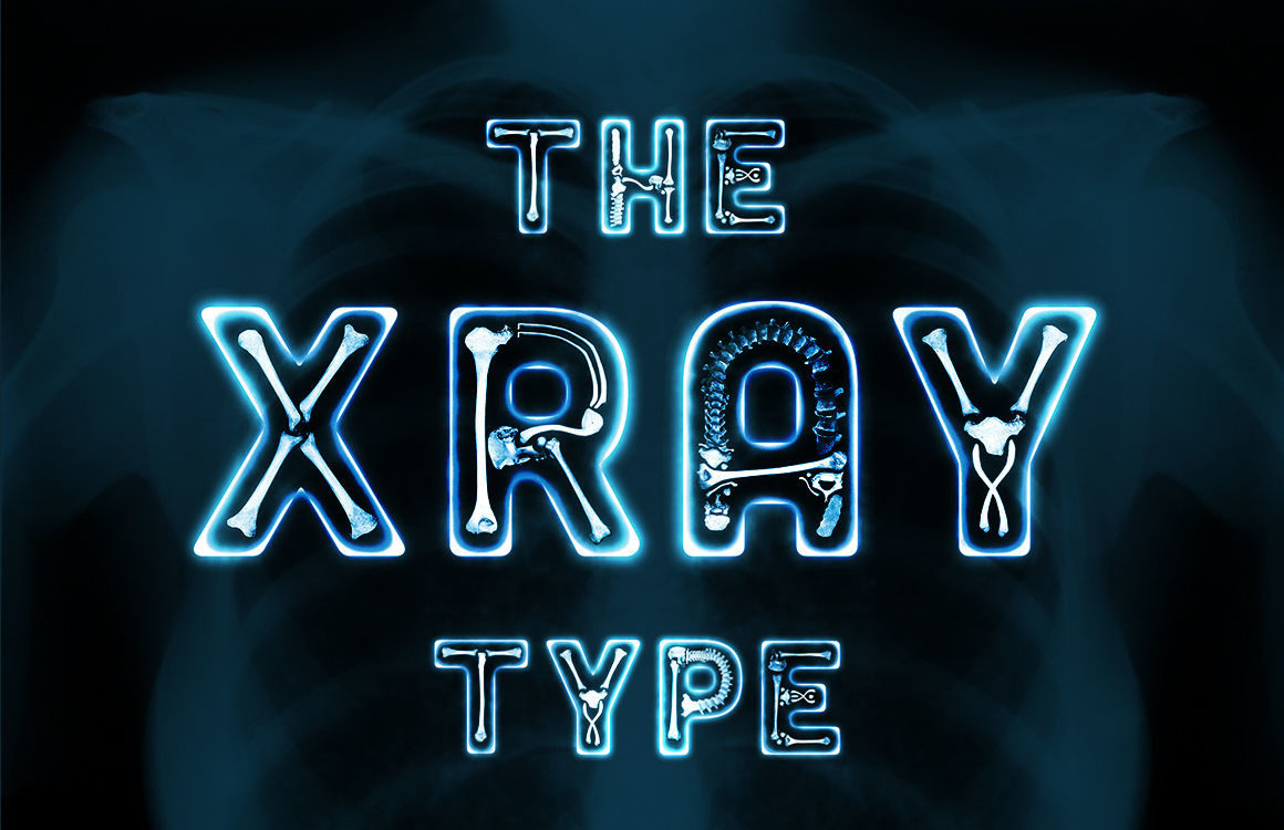 La fuente de rayos X 150718 TemplateMonster