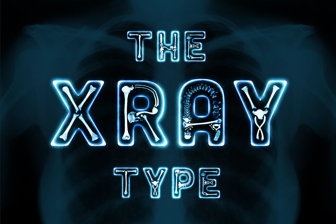 The XRay Font 150718