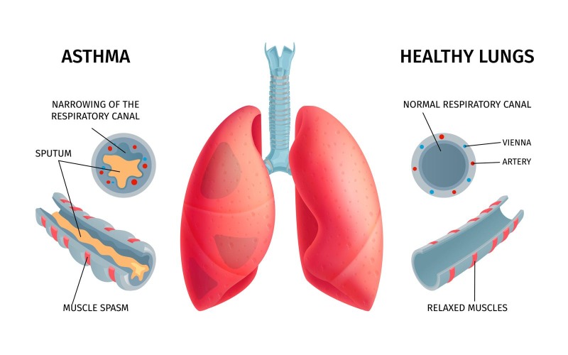 Human Lungs Anatomy Asthma Vector Illustration Concept