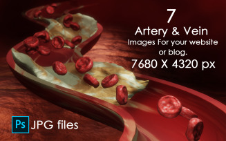 Best 7 High Resolution 3D Images Of Clogged Arteries And Arterial Plaque. Image Backgrounds