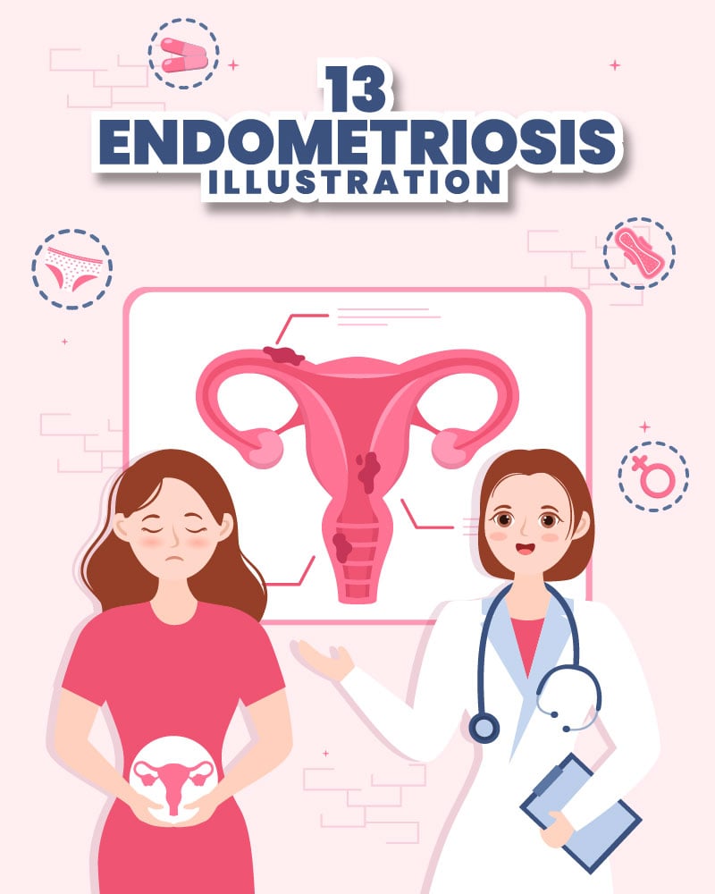 Kit Graphique #299770 Endometriosis Gyncologie Divers Modles Web - Logo template Preview
