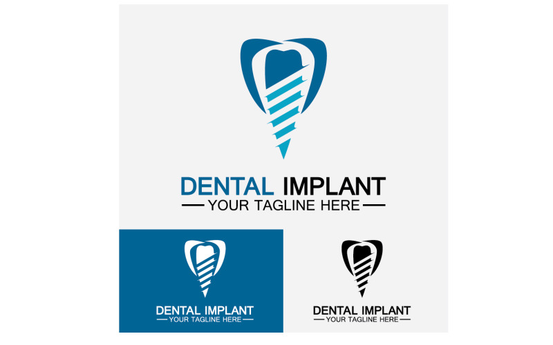 Dental logo design vector templatecreative dentist logo Version 1 Logo Template