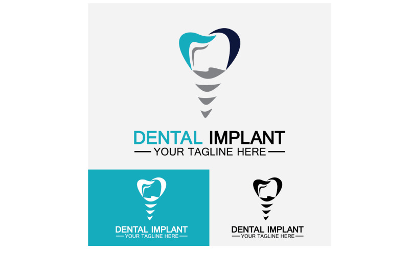 Dental logo design vector templatecreative dentist logo Version 2 Logo Template