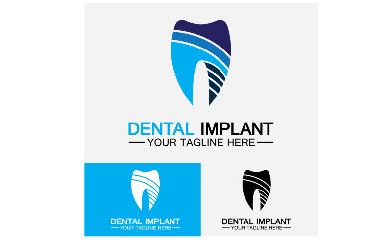 Dental logo design vector templatecreative dentist logo Version 9 Logo Template