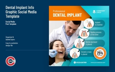 Modelo de Mídia Social Gráfico de Informações sobre Implantes Dentários