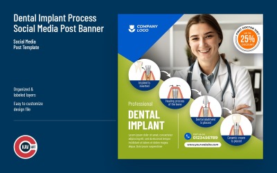 Plantilla de banner de publicación de redes sociales de proceso de implante dental