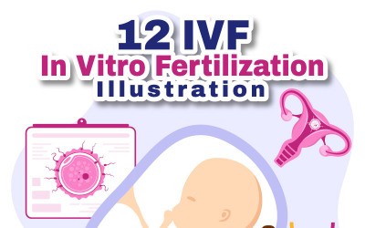 12 FIV o Fecundación In Vitro Ilustración