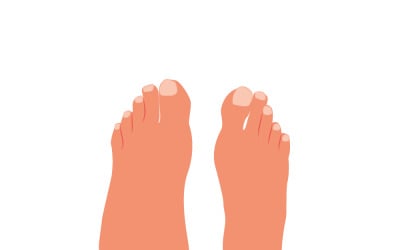 Swollen foot, normal foot. Before, after.