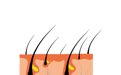 Pedaço de pele humana e toda estrutura de cabelo