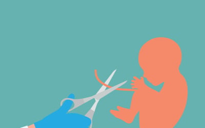 Cartoon Style Cutting Umbilical Cord Illustration