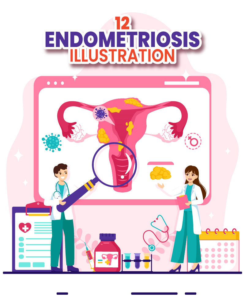 Kit Graphique #404036 Endometriosis Gyncologie Divers Modles Web - Logo template Preview