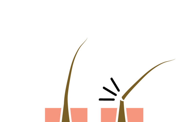 Hair Loss Vector Icon Symbol Isolated Illustration Vector Graphic