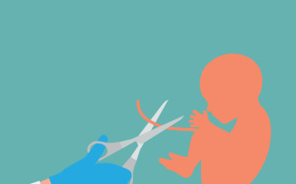 Cartoon Style Cutting Umbilical Cord Illustration