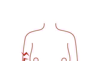Breast Self-Examination Guide Cartoon Medical Illustration