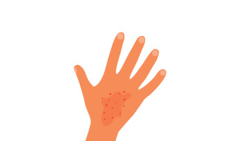 Medical Rash Icon on Hand and Arm Skin for Healthcare Websites