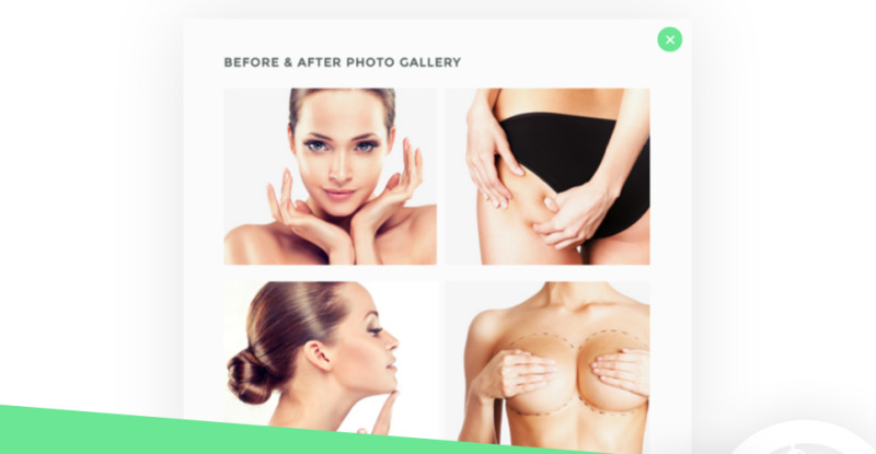 Perfecto - Plastic Surgery Website Template - Features Image 3