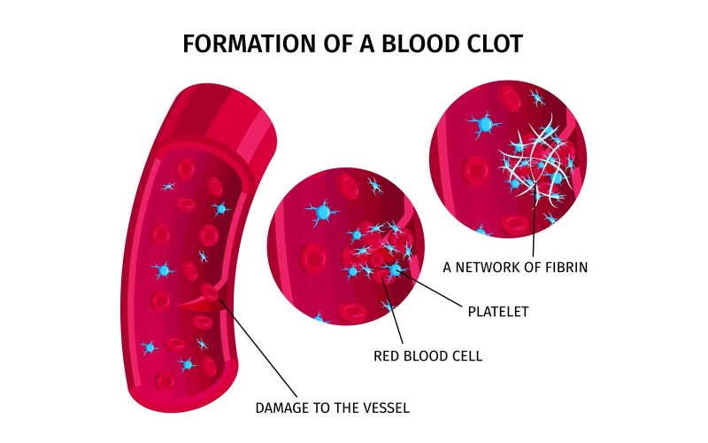 Vérsejtek trombus 201250414 vektoros illusztráció koncepció