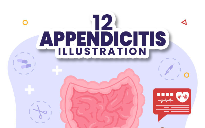 12 Appendizitis Entzündung Illustration
