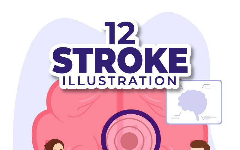 12 Ilustración de accidente cerebrovascular humano