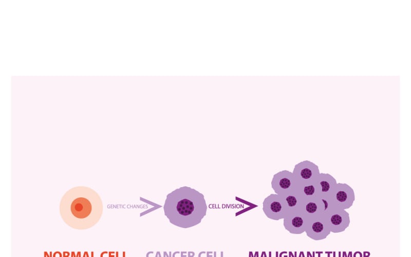 Crecimiento de tumores malignos: ilustración médica vectorial detallada del desarrollo del cáncer
